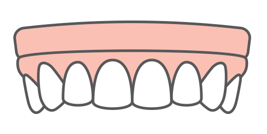 Implant dentures icon, one of our dental implant solutions