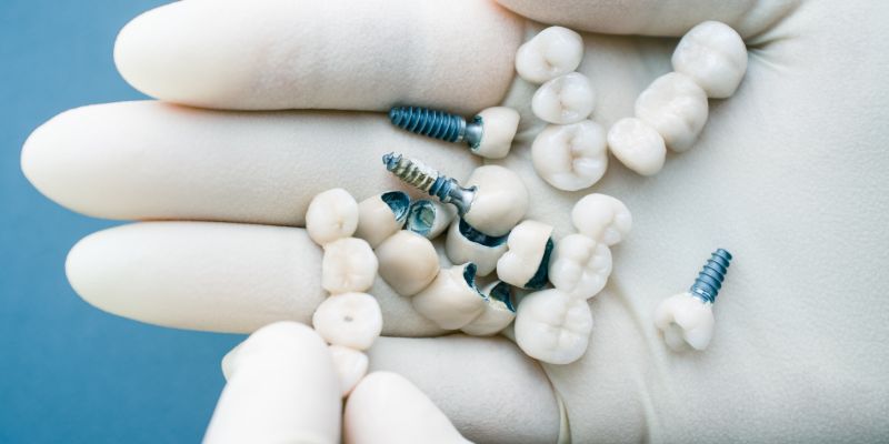 dental implants, crowns, and bridges in a gloved hand